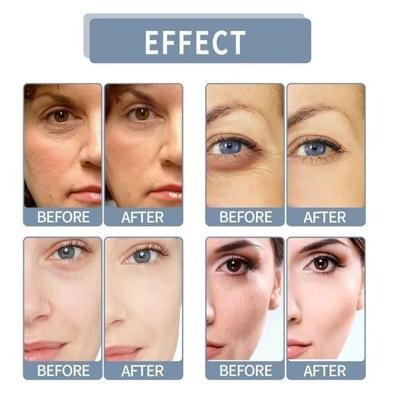 SKIN BRIGHTNING NIACINAMIDE SERUM